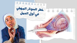 خطر السونار المهبلى فى أول الحمل  |د. ريهام الشال