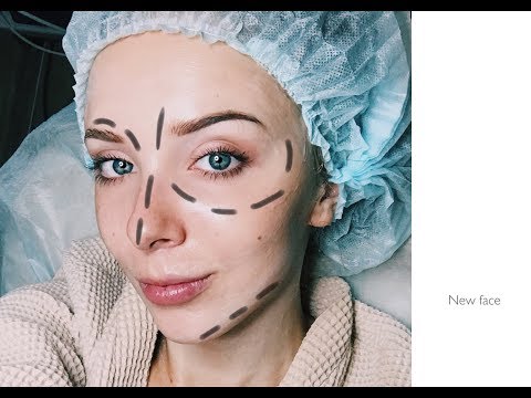 Видео: Новое лицо//Так ли дорого стоят услуги косметолога
