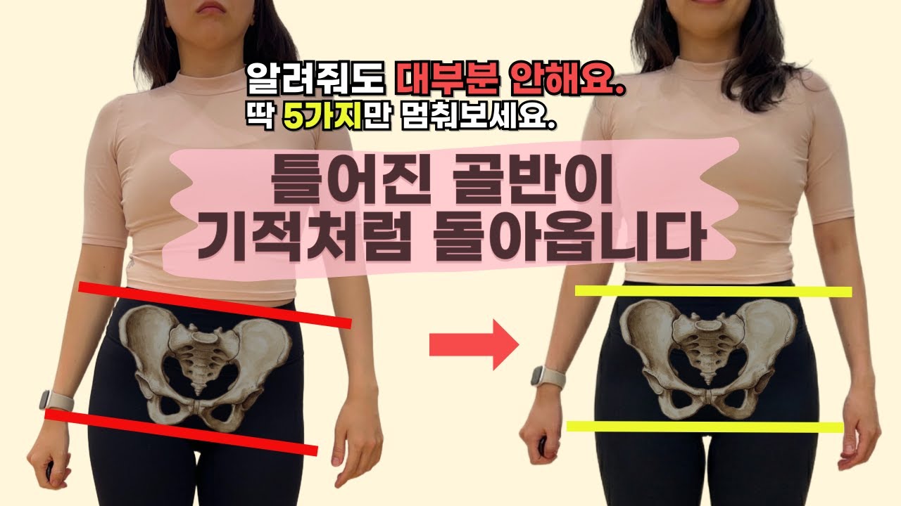 알려줘도 안 하는 골반 교정 습관 5가지 (하루 5분, 평생 가던 허리 무릎 통증 끝납니다)
