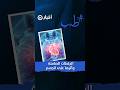 دراسة: الجلطات "الصامتة" تهدد الذاكرة مع التقدم بالعمر