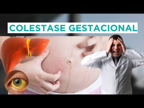 Vídeo: Quando começa a colestase intra-hepática da gravidez?