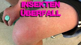 Insekten Überfall auf mich | Allergischer Schock, 4h Notaufnahme - aber alles gut gegangen