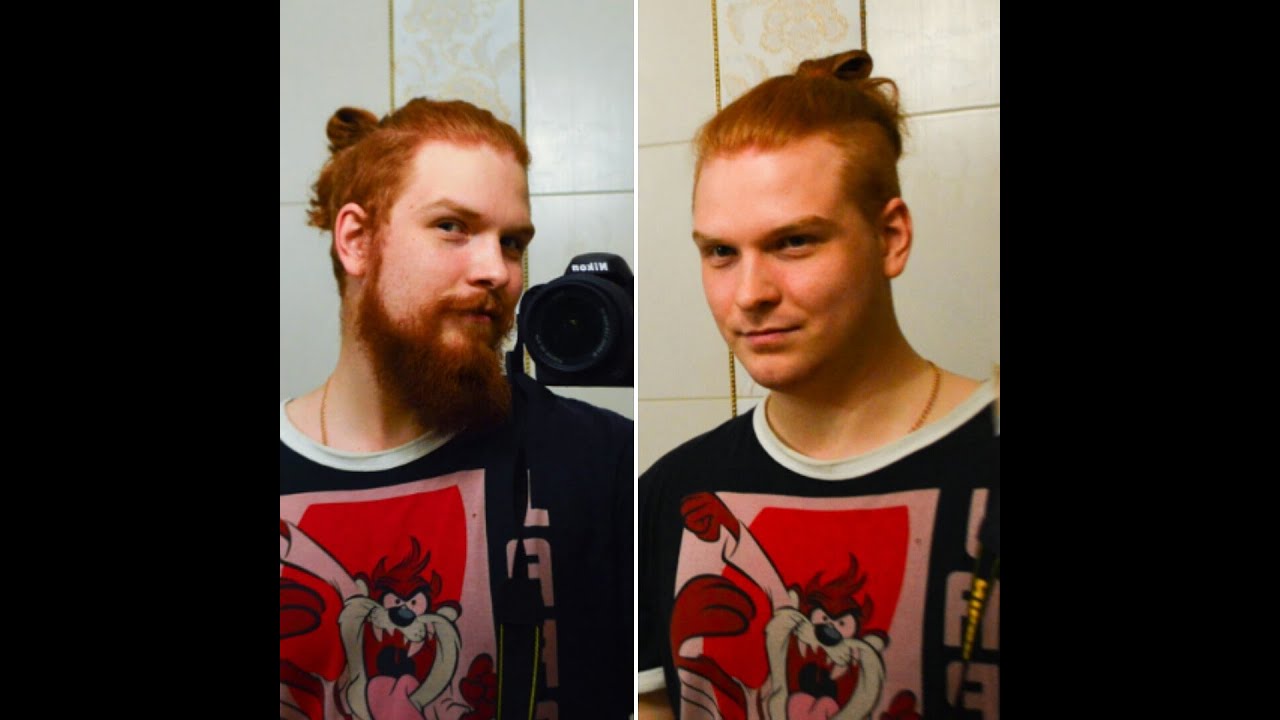 Getting Rid Of Ginger Beard D YouTube
