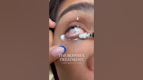 Blephex Procedure Video