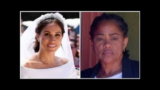 K Dokonalému Vzhledu Si Meghan Pomohla Plastikami Řezali Jí Hlavně Do Nosu, Shodují Se Odborníci