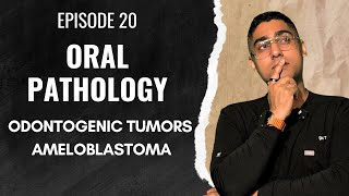 Dental Digest Oral Pathology Episode 20 - Ameloblastoma
