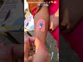IV Cannulation Practice/USA Nursing Hospital #youtubeshorts #usa #reels #viralshorts #trendingshorts