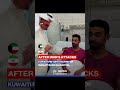 🇰🇼🇮🇷 Kuwait PM visits injured after Iranian strikes