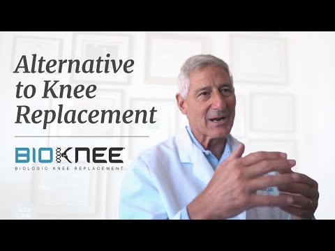 An Alternative to Knee Replacement: The BioKnee®