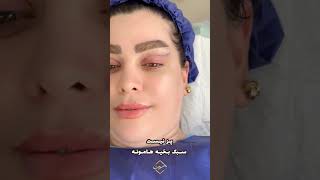بلفاروپلاستی با بخیه لیزری در کلینیک زیبایی رنسانس