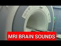 Mri sounds inside scan room brain mri noise  sound effects mri 