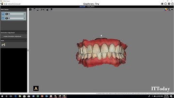 How To Export Teeth STL File From CS Imaging Software