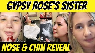 Famous Gypsy Rose’s Sister UNRECOGNIZABLE! Nose Job & Chin Implant! 😱 Wealth
