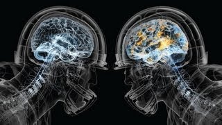 NFL Football Hits, Concussions, Injuries & a Lifetime of Pain