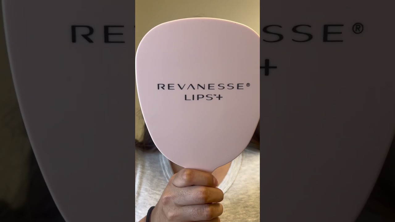 Lip filler transformation 💋💉✨! 