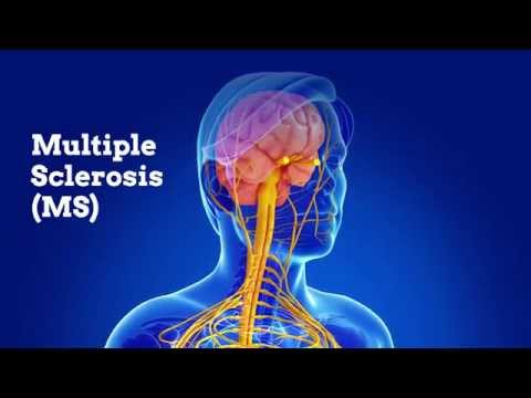 AJE Video Bytes