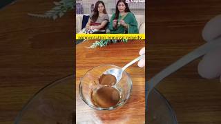Pigmentation Removal Remedy | How To Get Rid of Pigmentation | Natural Glowing Skin Hacks #darkspots