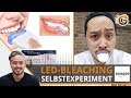 LED-Bleaching: Weiße Zähne in 20 min? | Selbstexperiment