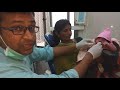 How to properly feed child with cleft lip and palate in Hindi
