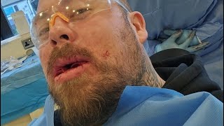 Post Surgery Live I didnt realise how bad it was