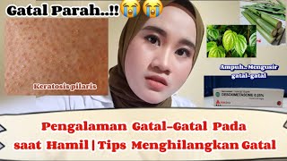 Pengalaman Gatal-Gatal Pada saat Hamil | Cara Mengatasinya