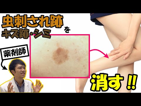 なかなか消えない【跡・シミ】を消す方法紹介！オススメの製品と日常生活での対策編