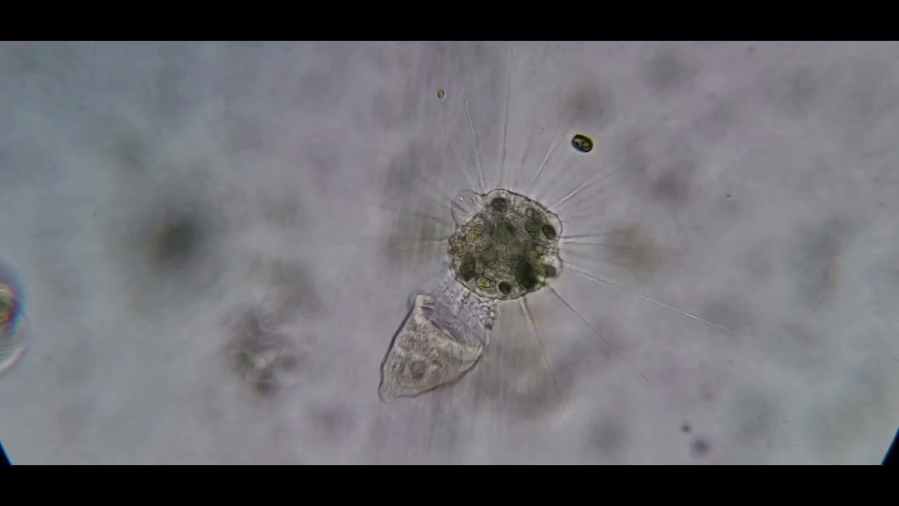 Heliozoa eats vorticella. 400x magnification 8x speed