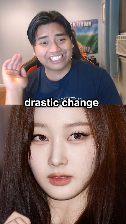 K-Pop Idols Before/After Surgery! #kpop #plasticsurgery #idol