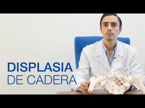 Video: ¿Quién trata la displasia fibrosa?