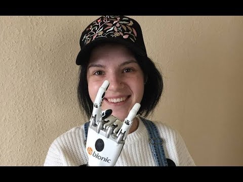 Video: Margarita Gracheva, Kojoj Je Suprug Odsjekao Ruke, Dobila Je Bionsku Protezu - Alternativni Prikaz