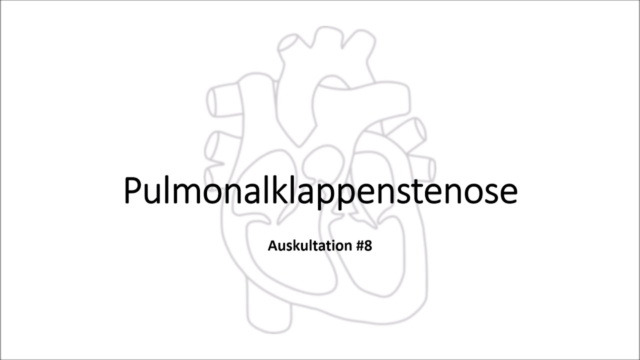 Anton Pulmonalis Trinkt Milch Auskultation #8: Pulmonalklappenstenose - YouTube