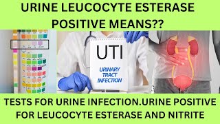 Urine Extion Leucocyte Esterase Positive .Uti, Urinary Nitrite And Leucocyte Esterase Positive