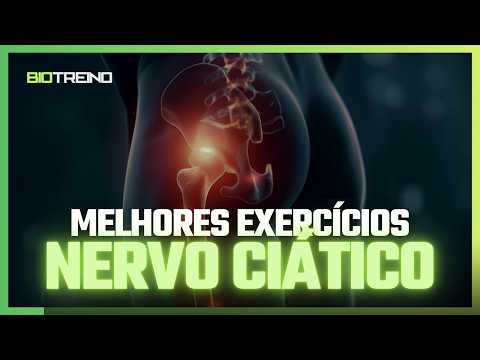 Sciatic pain? Do this today!