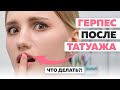 Герпес после татуажа губ. О чем нужно знать заранее. Студия татуажа DUBOVIK в Краснодаре