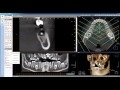 How to Create a Panoramic Curve in LED Dental&#39;s Xelis 3D Imaging Software
