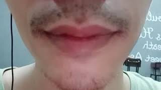 Keluar cacing dari hidung