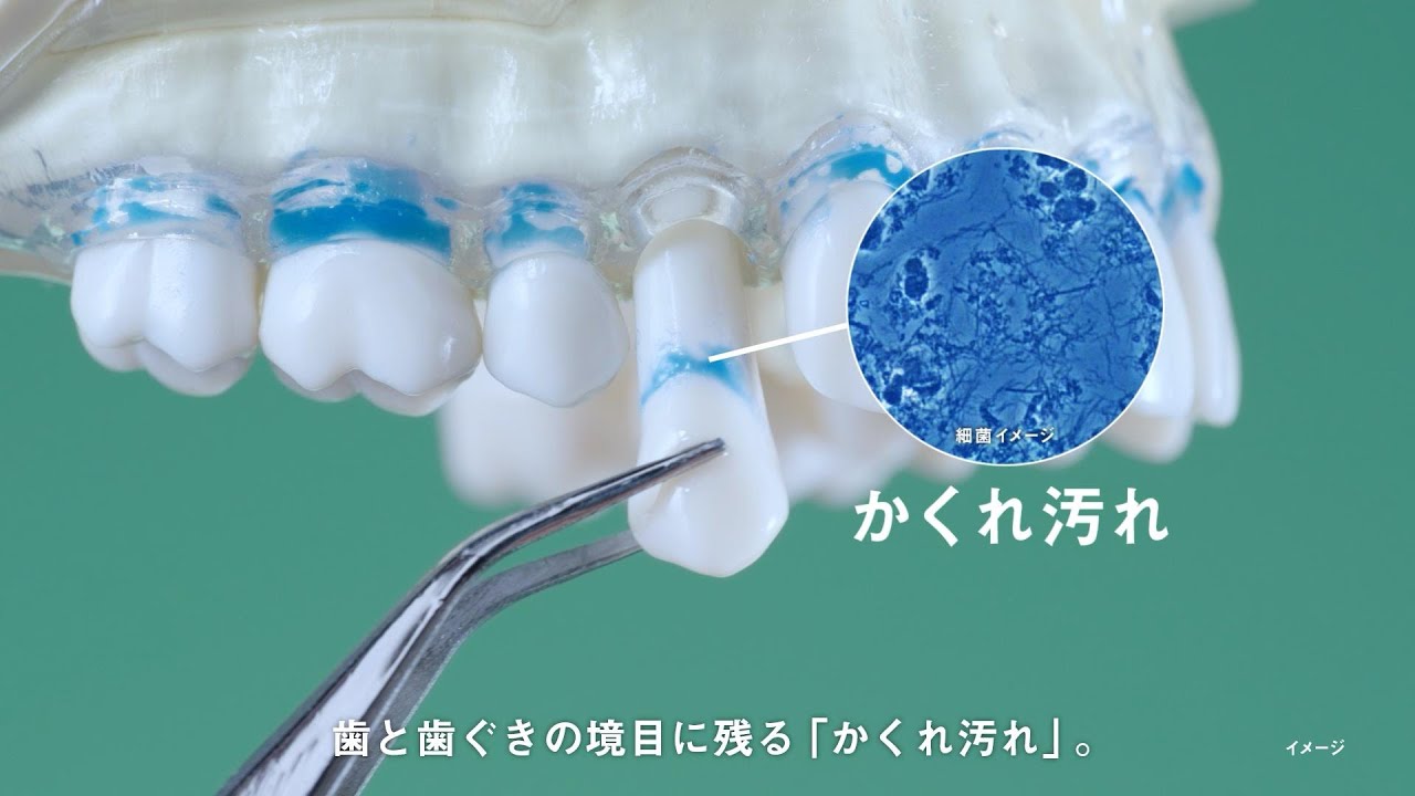 ドルツ水流洗浄器ジェットウォッシャーかくれ汚れ落とし実証動画