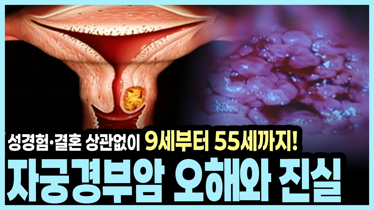 감기처럼 흔한 인유두종 바이러스! 방치하면 침윤성 자궁경부암 된다? I KBS 알약톡톡 20130615 방송
