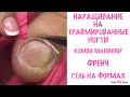 НАРАЩИВАНИЕ НА ТРАВМИРОВАННЫЕ НОГТИ/ФРЕНЧ/ГЕЛЬ НА ФОРМАХ/КОМБИНИРОВАННЫЙ МАНИКЮР