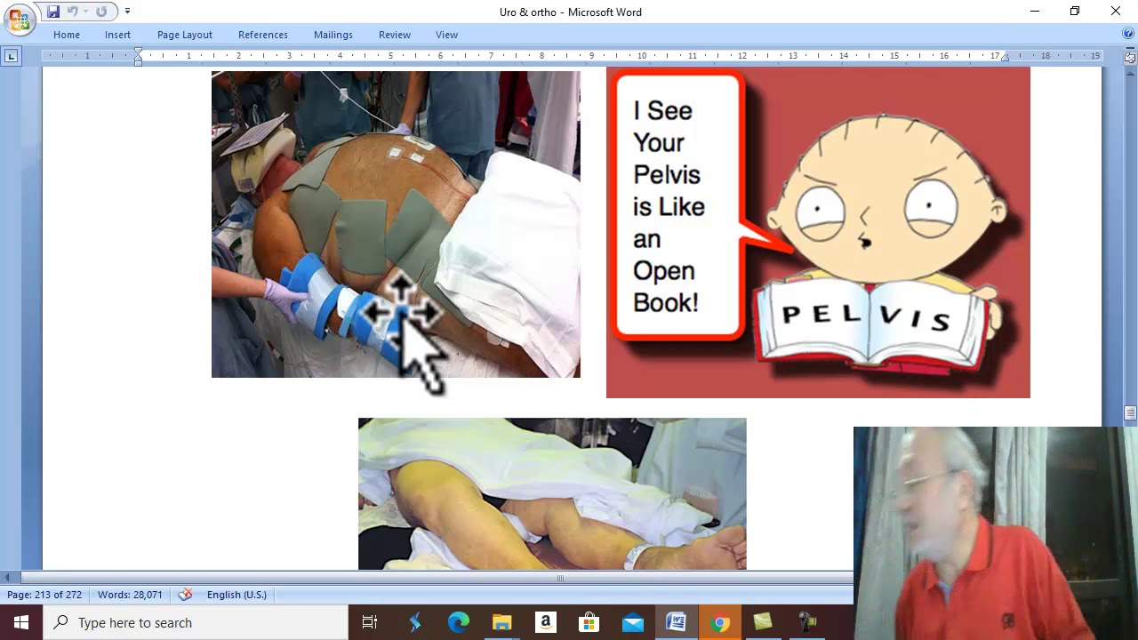 Orthopedic in Arabic 30 ( Fracture pelvis , part 2 ) , by Dr. Wahdan