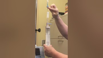 Priming the Buretrol (OSCAR)