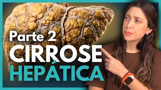CIRROSE HEPÁTICA: Classificações, Diagnóstico e Tratamentos - parte 2