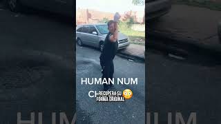 Que Pasa Si Te Fracturas Y No Vas A El Hospital