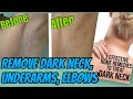 How to Lighten Dark Underarms & Dark Neck at Home | Home remedy to get Rid of Dark underarms & Neck
