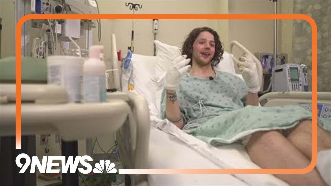 Windsor man accidentally sets himself on fire, shares message of ...