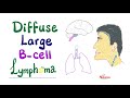 Diffuse Large B-Cell Lymphoma (DLBCL) | Aggressive  B-Cell Non-Hodgkin’s Lymphoma