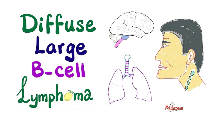 Diffuse Large B-Cell Lymphoma (DLBCL) | Aggressive  B-Cell Non-Hodgkin’s Lymphoma - DayDayNews