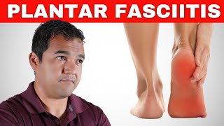 Top 6 Exercises for Healing the Root Problem of Plantar Fasciitis