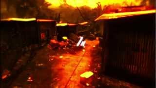 Dialysis|Mw3Montage|CallTheDoctor!