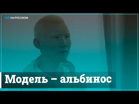 Модель – альбинос